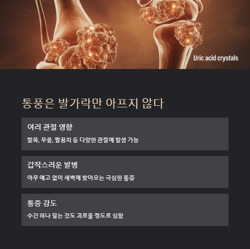 통풍은 발가락만 아프지 않다
