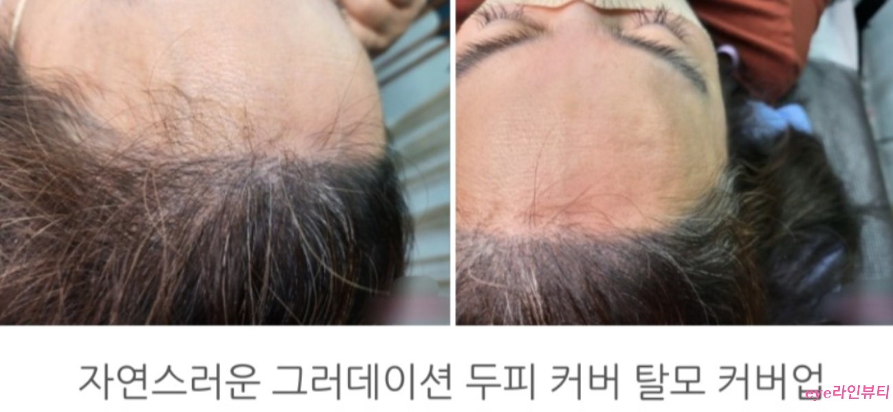  전주두피문신 블로그에서 가장 인기글 1편