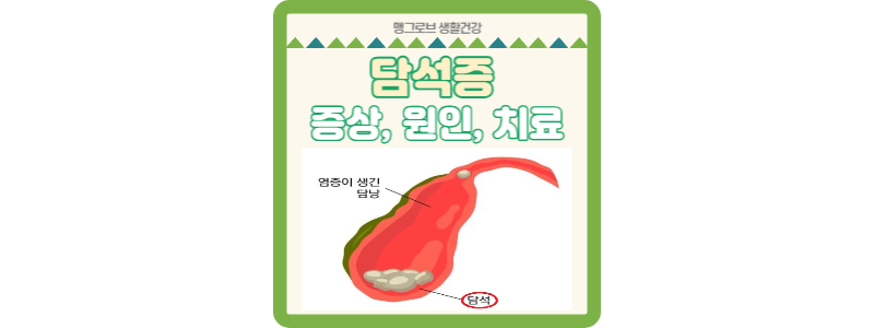 담석증 썸네일
