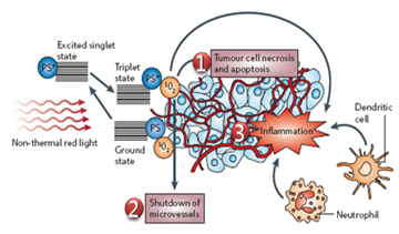 The mechanism of action on tumors in photodynamic therapy