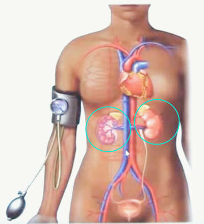 신장 기능이 좋지 않은 증상입니다.