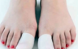  내성발톱 자가치료