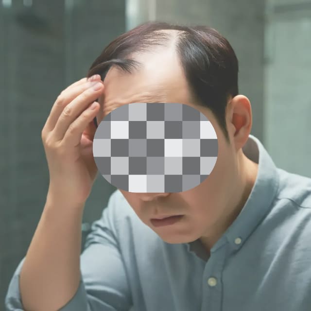 탈모약-쉐딩-현상-기간별-과정2