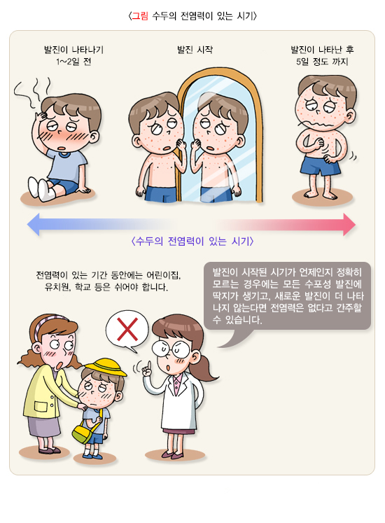 수두 전염기간