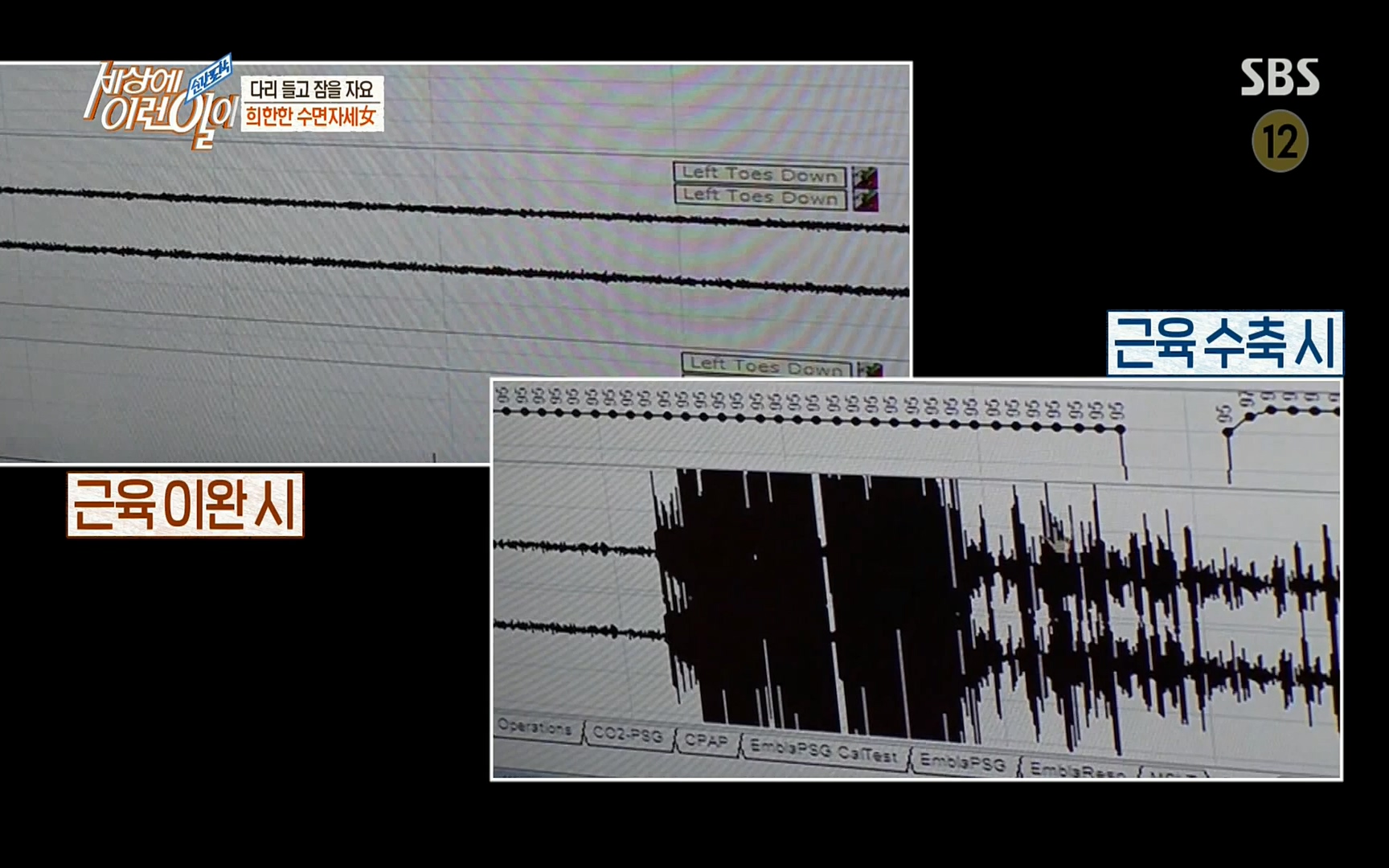 순간포착 세상에 이런일이.E1191.220802p.H264-F1RST.mp4_20220803_202142.497.jpg