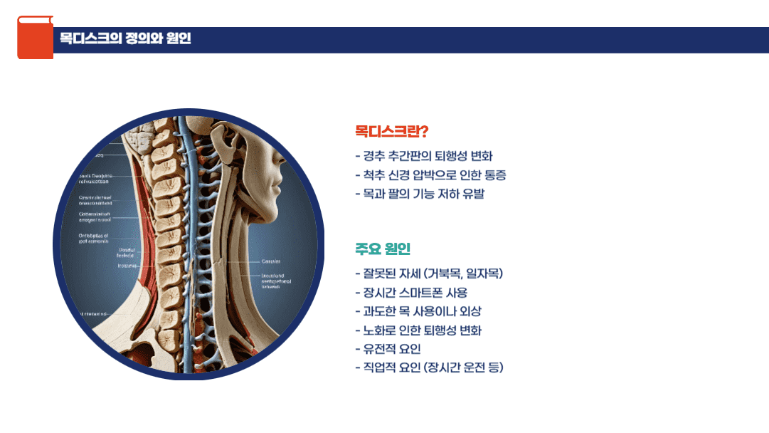 목디스크의 정의와 원인