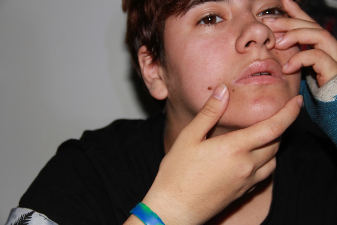 Nosebleed