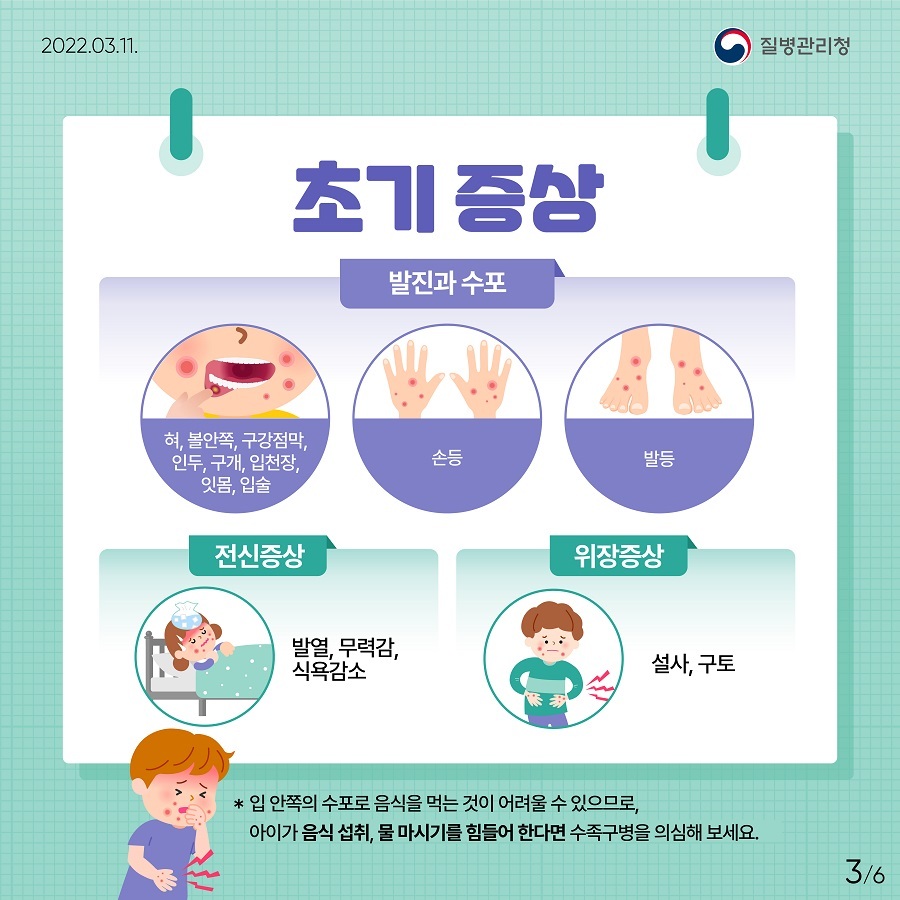  수족구병 원인 증상 주의사항