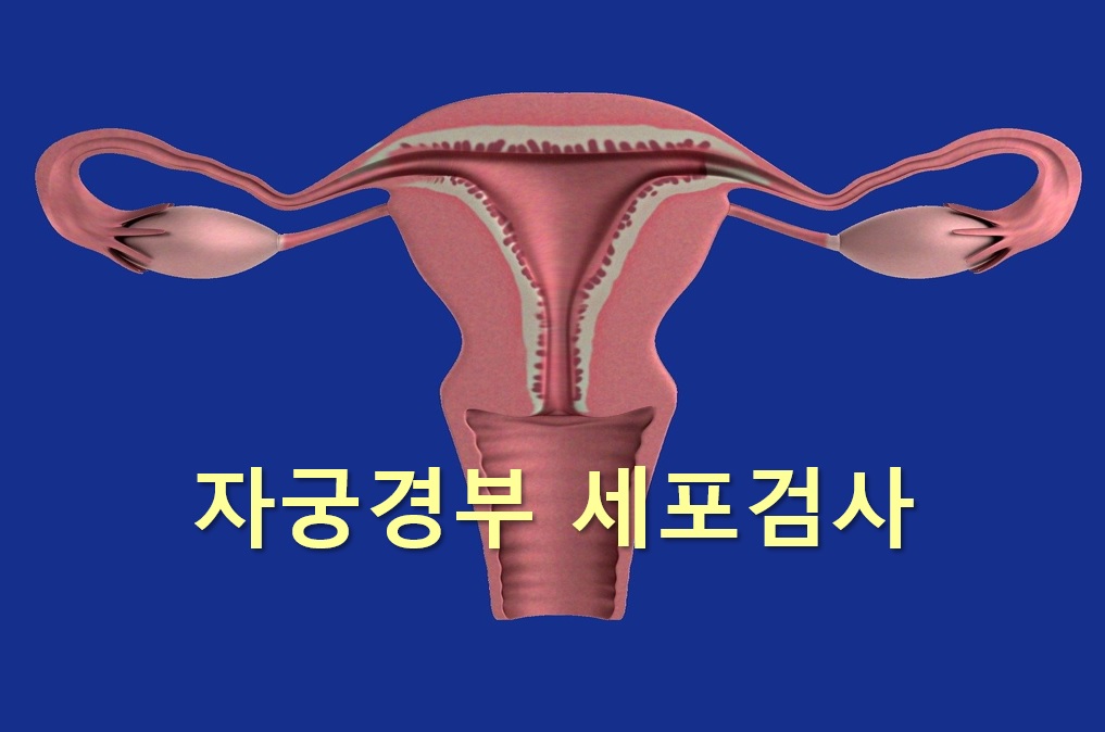  자궁경부암을 진단하는 자궁경부 세포검사