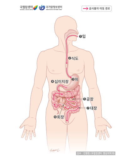 위암이해하기:증상&#44;원인&#44;진단&#44;치료방법