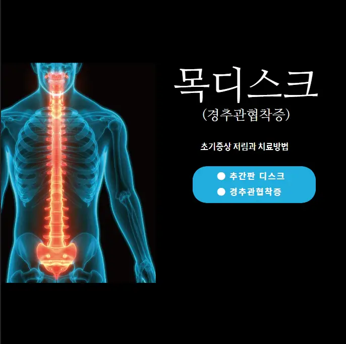 목디스크-경추관협착증-초기증상-저림-및-치료-방법