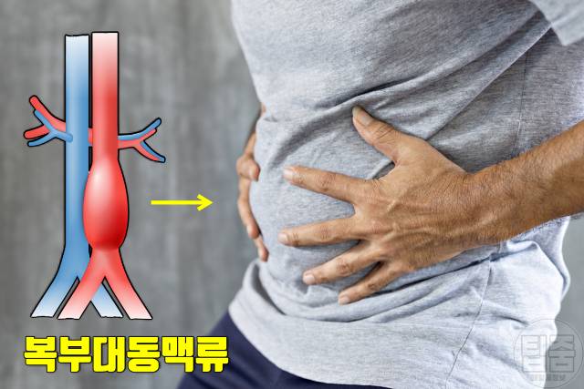 배에서 심장박동 복부대동맥류 증상 복부대동맥류 자가진단 복부팽만감 구역질