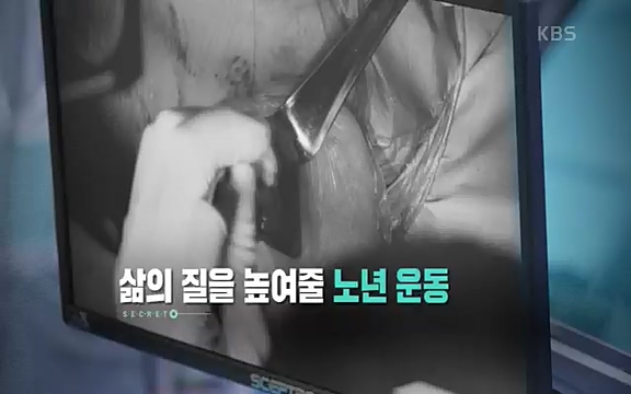 [821회] 생로병사의 비밀 - KBS821회] 생로병사의 비밀.ts_20220824_145719.899.jpg