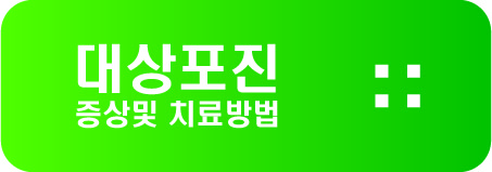  대상포진 증상및 치료방법