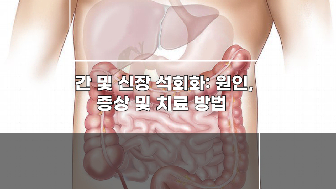 간 석회화