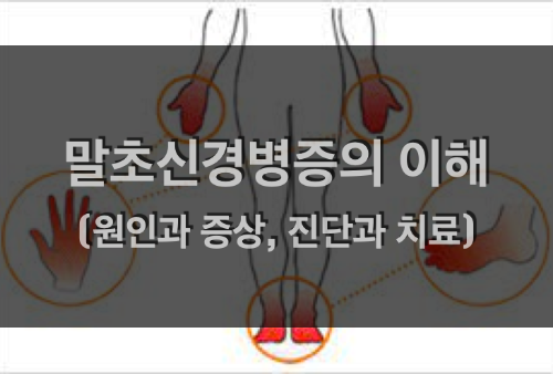  말초 신경병증의 원인, 증상, 진단, 치료 및 완화 방법