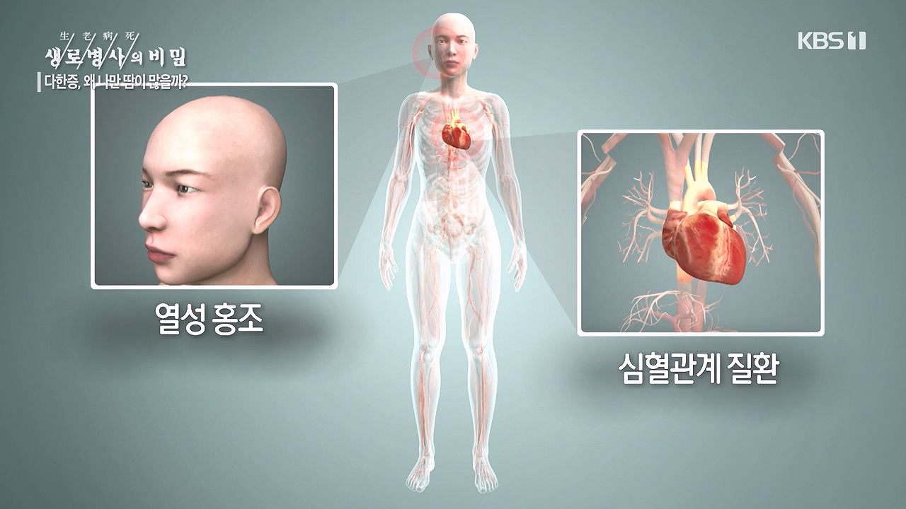 생로병사의 비밀.E882.230907p-NEXT.mp4_20230908_211837.656.jpg