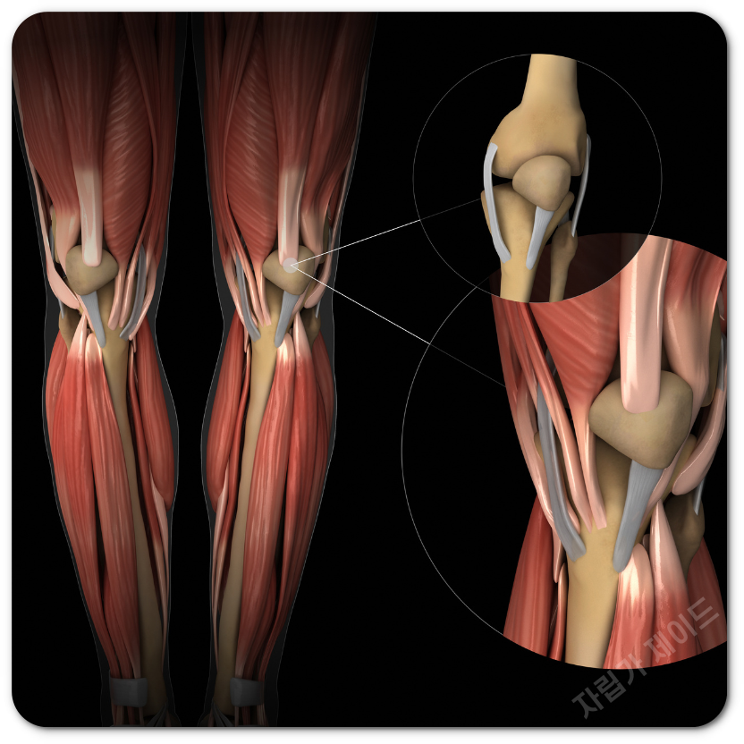 무릎 인대 파열 증상 치료법 총정리