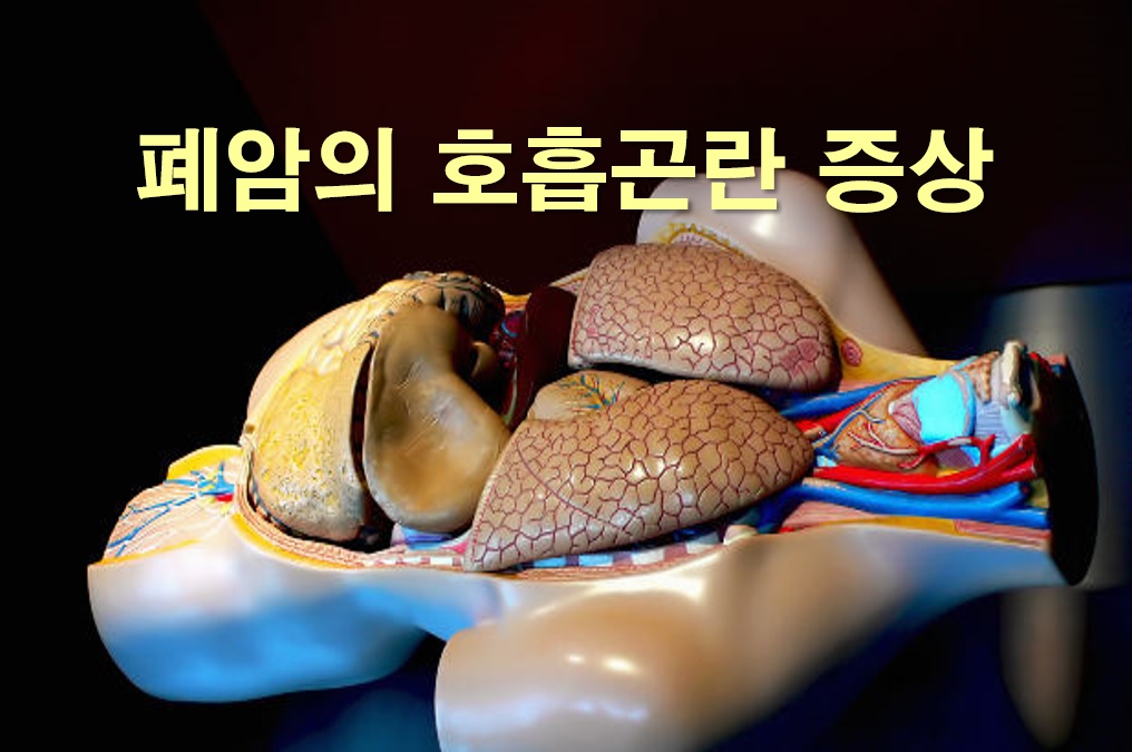  폐암의 호흡곤란 증상