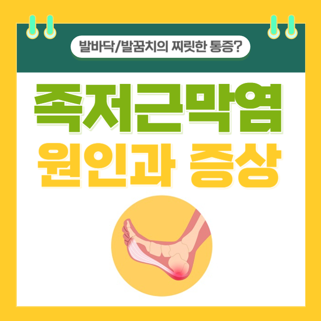  발바닥과 발꿈치의 찌릿한 통증? 족저근막염의 원인과 증상 총정리
