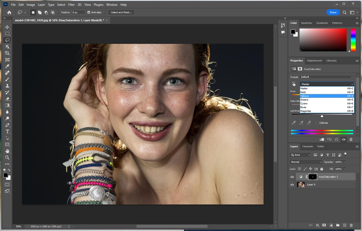 치아색상 변경을 위한 색 선택