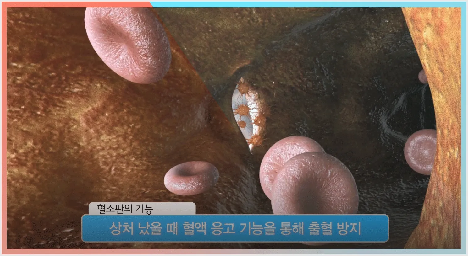 혈소판수치가 높으면