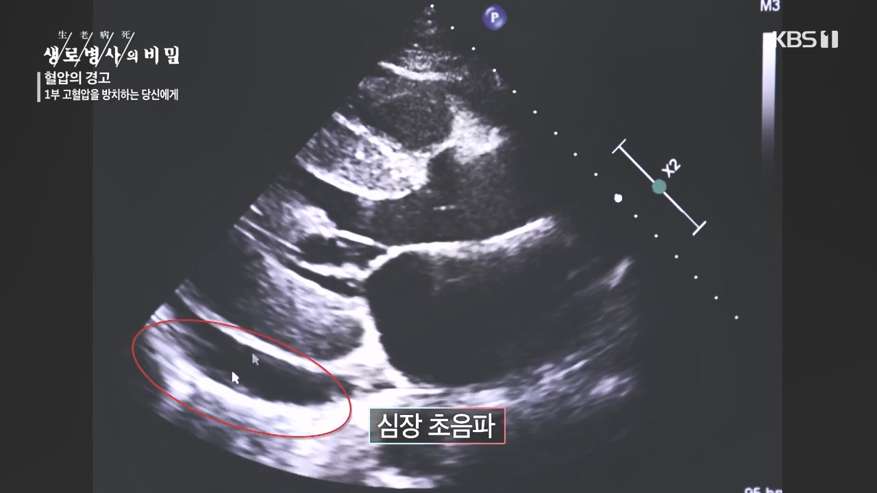 생로병사의 비밀.E887.231026p-NEXT.mp4_20231026_203158.112.jpg