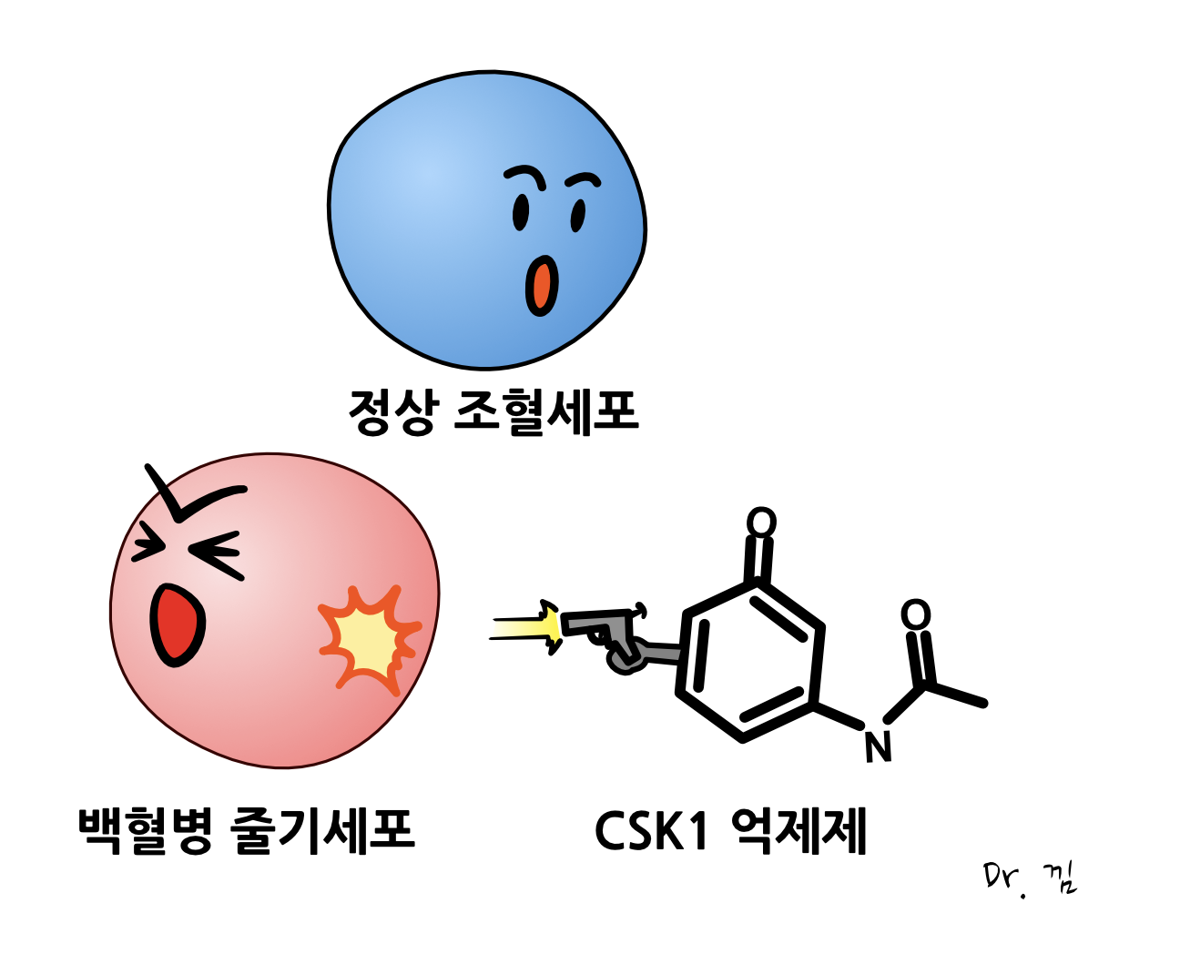  급성 골수성 백혈병 치료를 위한 치료제 연구, CKS1 억제제