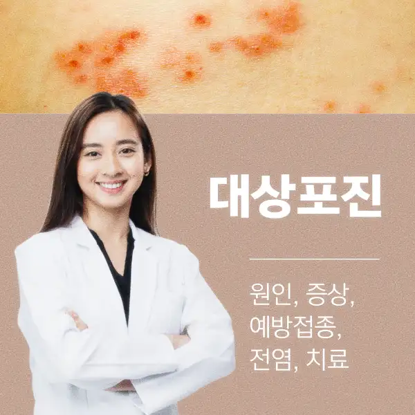 대상포진 원인&amp;#44; 증상&amp;#44; 예방접종&amp;#44; 전염&amp;#44; 치료