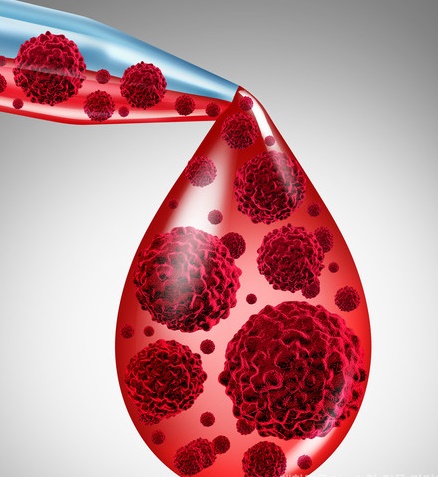 혈액암 생존율