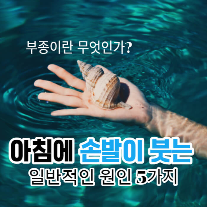 아침에-손발이-붓는-5가지-이유-썸네일