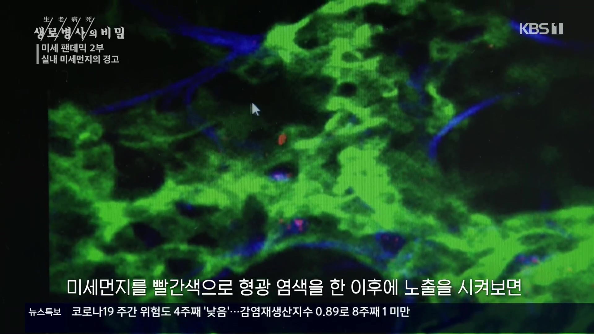 생로병사의 비밀.E840.221019p.H264-F1RST.mp4_20221020_175129.021.jpg