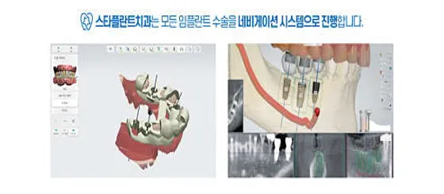 스타플란트치과의원