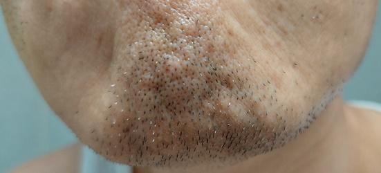 면도전 턱수염