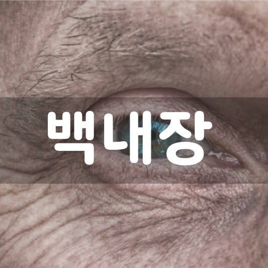  백내장 증상과 자가 진단, 수술 비용 실비 보험, 수술 후 관리 후유증 한번에 알아보기!