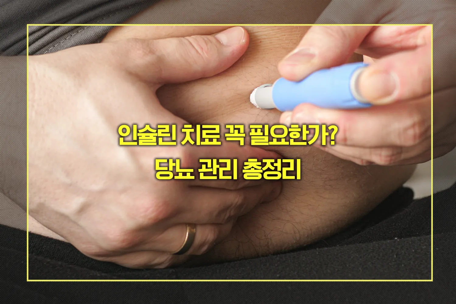 인슐린 치료 당뇨 관리