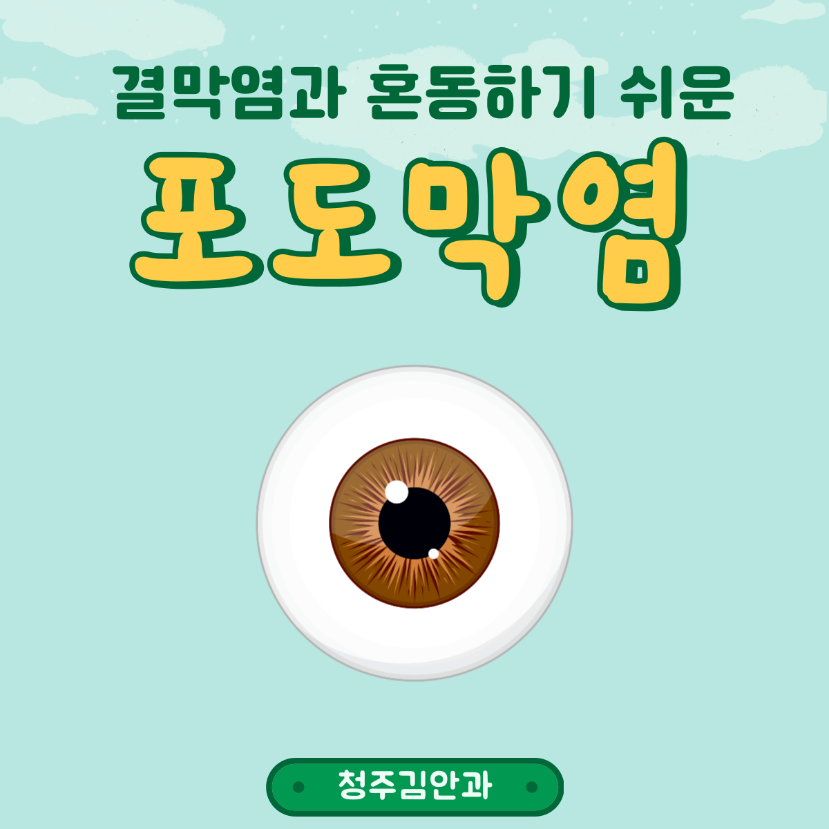  포도막염 원인 및 증상, 예방법까지!