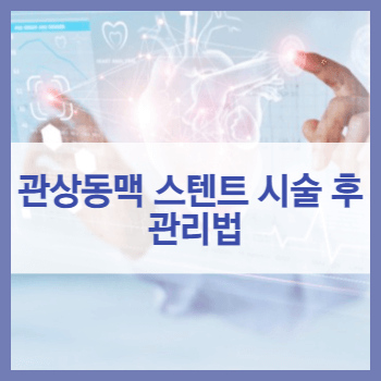 관상동맥 스텐트 시술후 관리법