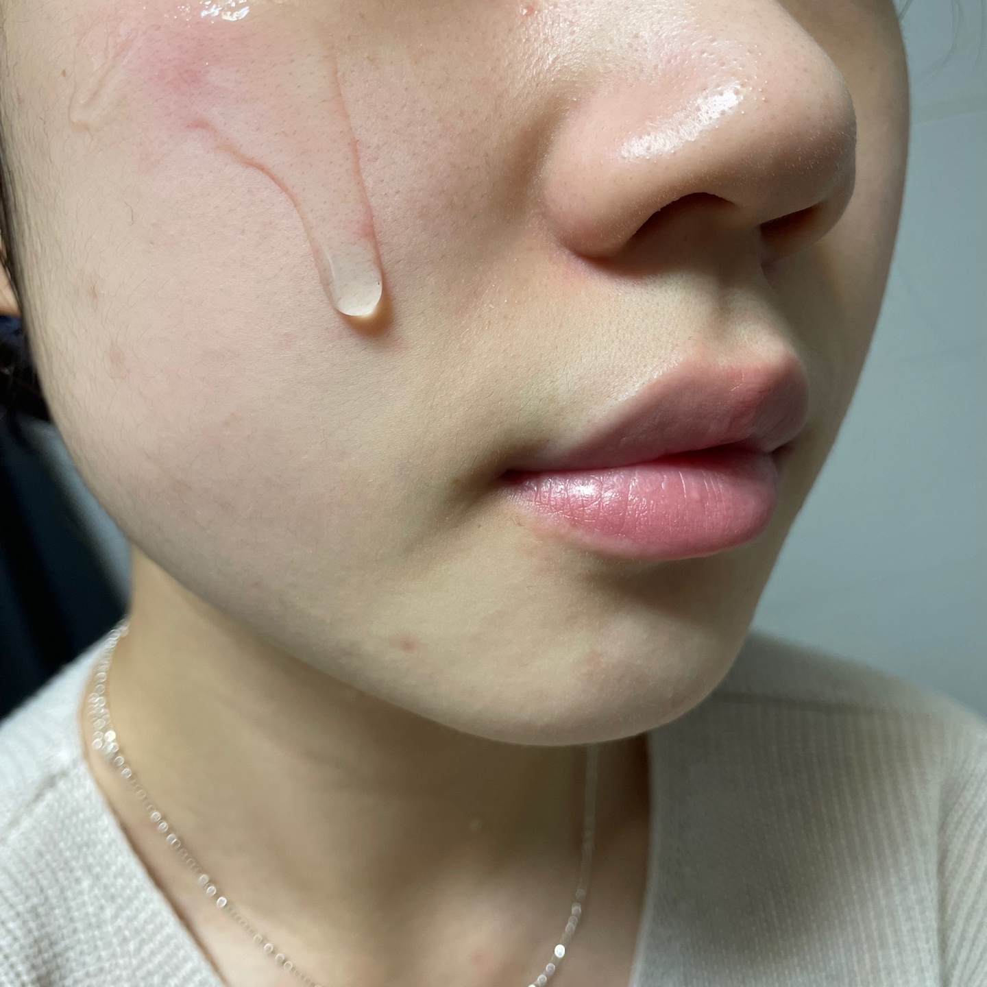 여드름 화장품은 피부 트러블이 있는 중학생에게 적합합니다! 톤을 명확하게 유지하십시오. 11