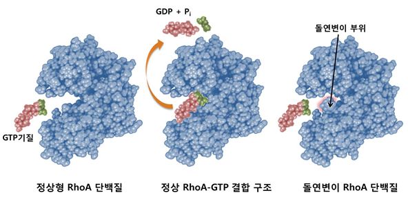 림프절 위치