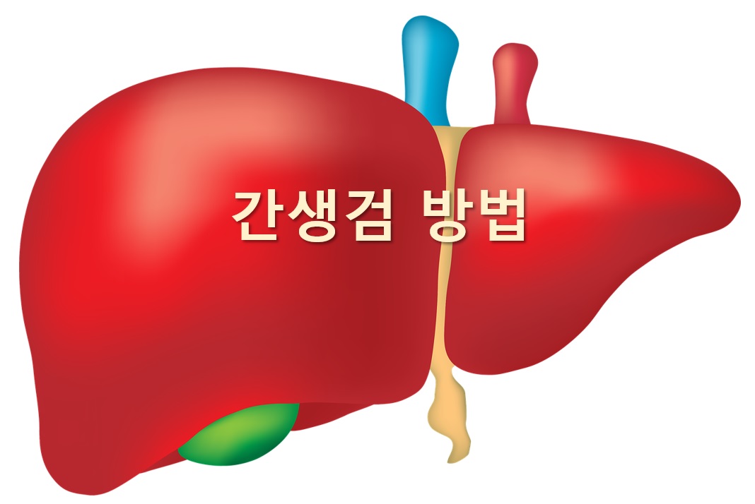  간질환 진행 정도를 확인하기 위한 간생검 방법
