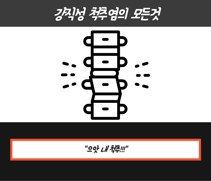 강직성 척추염