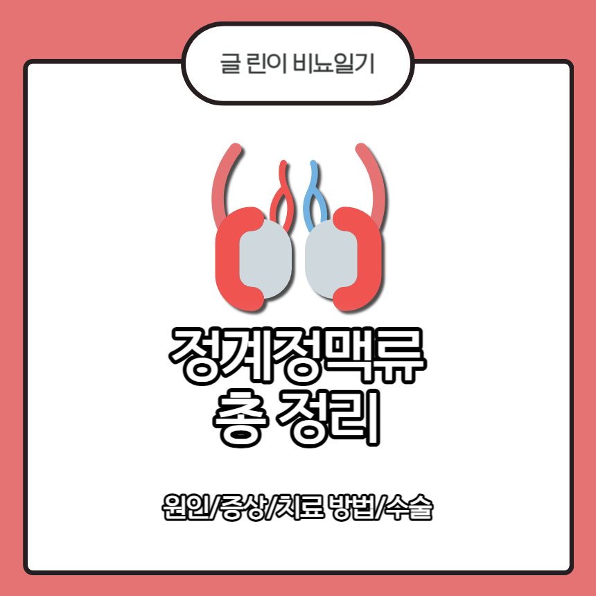  정계정맥류 총 정리