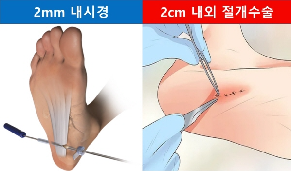 수술적 치료