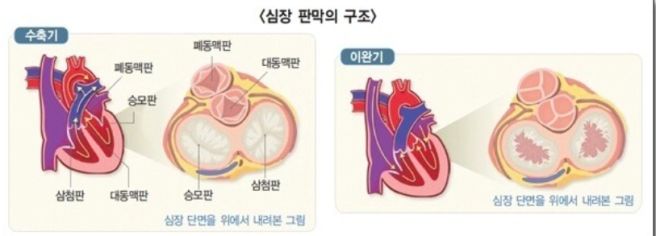 심방 세동 증상