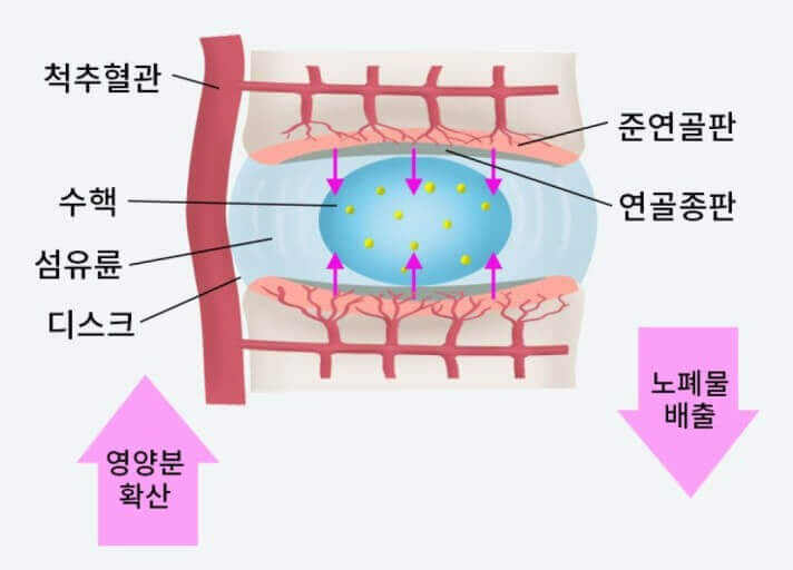 관절 안에 들어 있는 디스크와 수핵의 모습