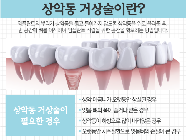 에스프라임 이미지