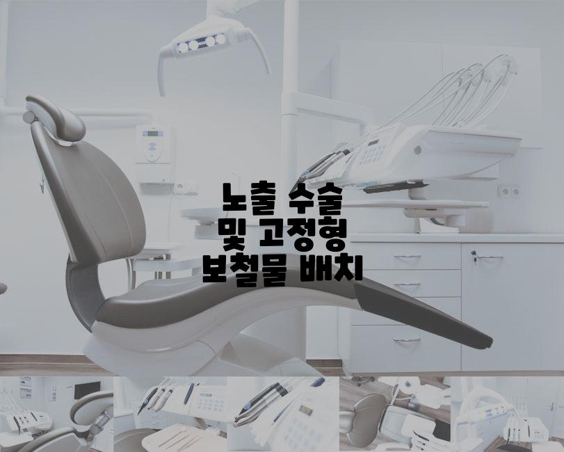 노출 수술 및 고정형 보철물 배치