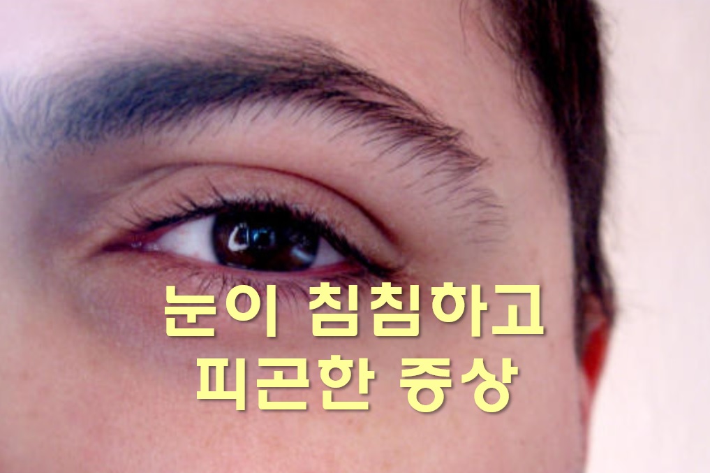  눈이 침침해지는 이유와 피곤한 증상