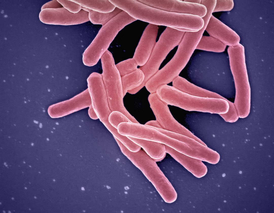 Tuberculosis